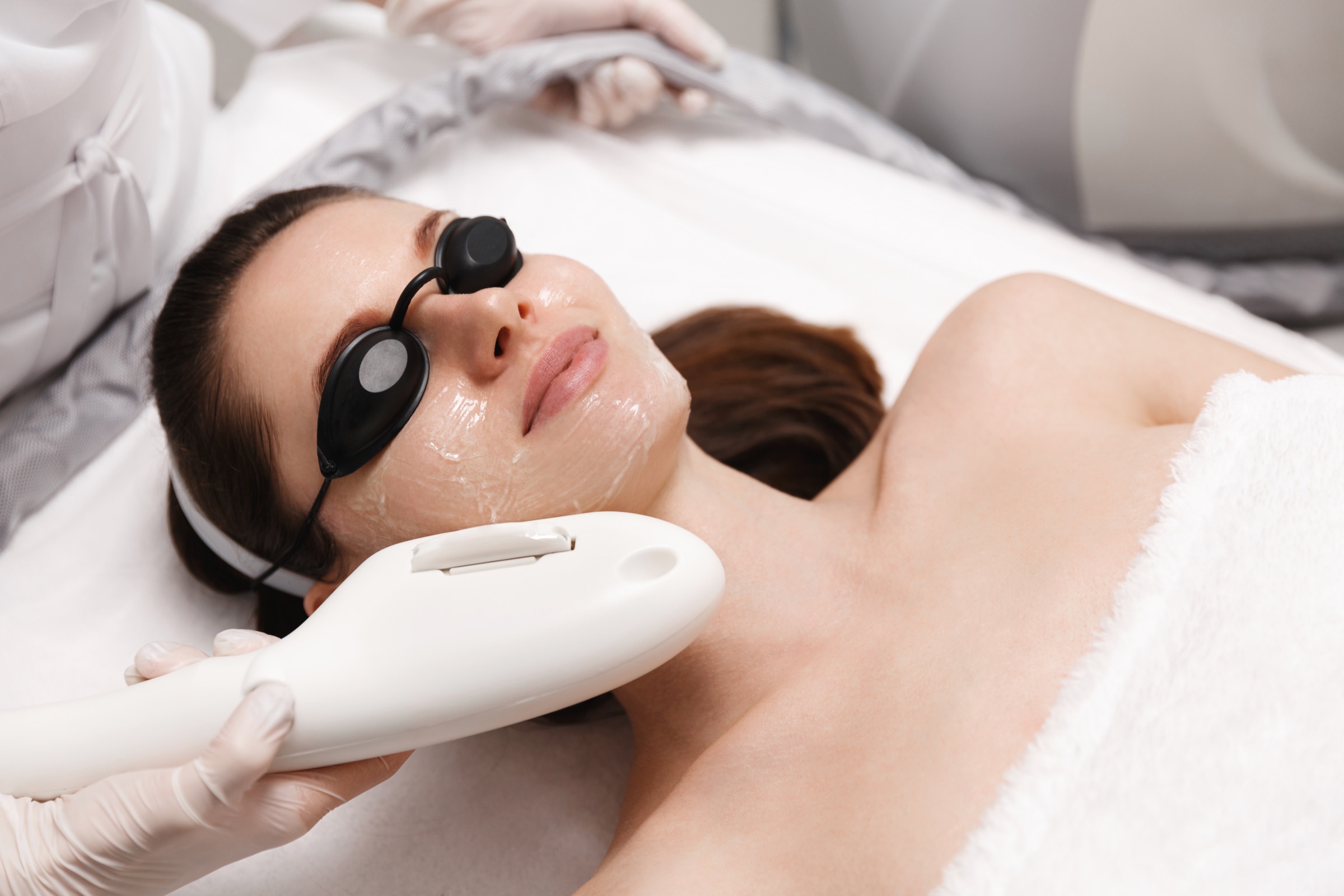 IPL facial treatment at Nuderma Health & Med Spa in Raleigh
