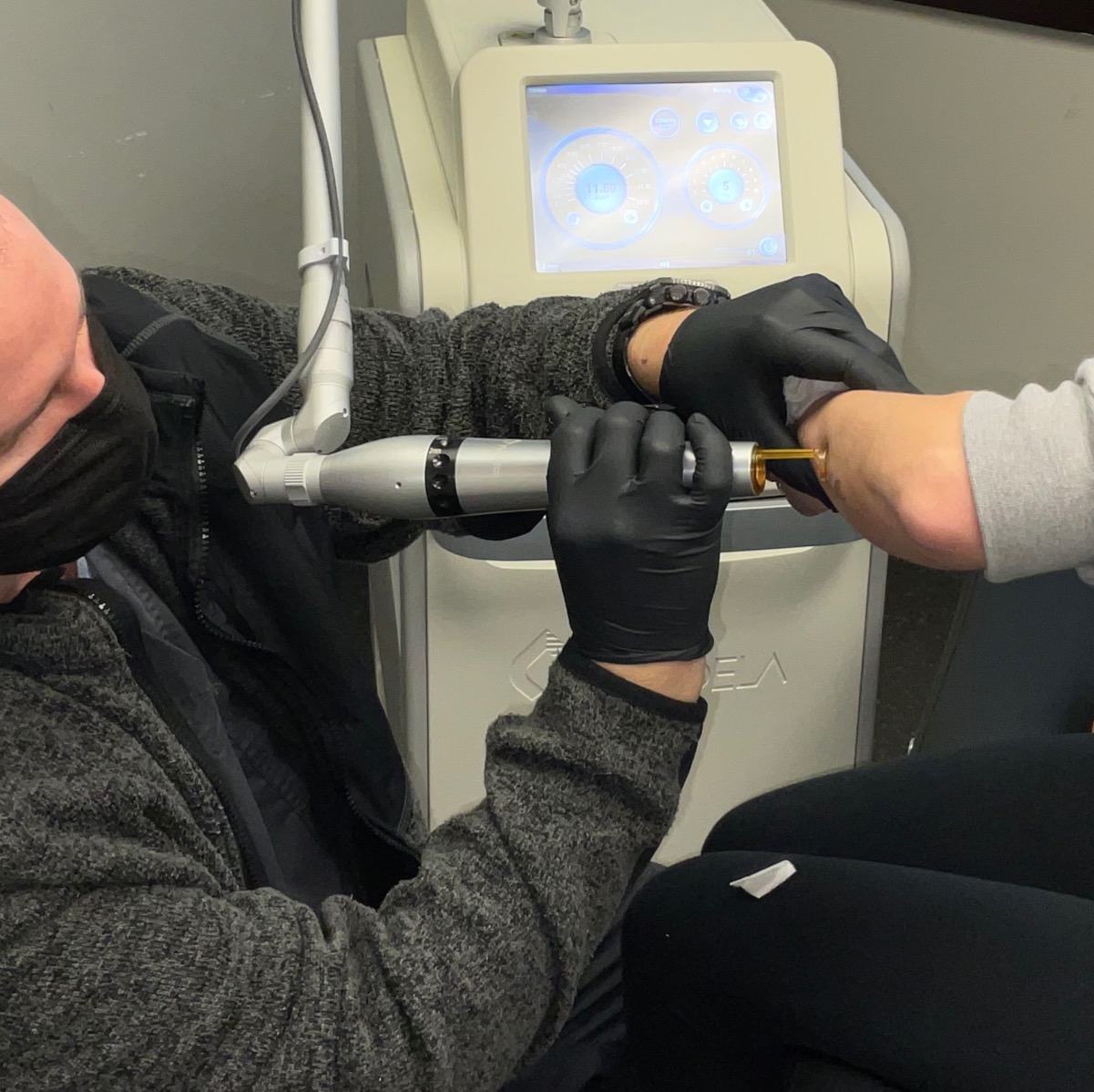 Laser tattoo removal treatment at Nuderma Health & Med Spa